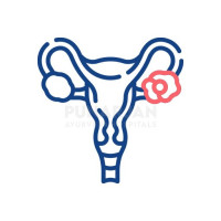 Best Ovarian Cancer Treatment Hospitals in Bangalore