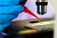 Top Stem Cell Therapy Hospitals in India