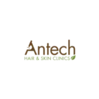 Female Hair Loss Toronto | Female Hair Loss | Female Hair Loss Treatments