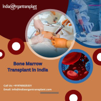 Low Cost Bone Marrow Transplant in India