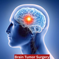 Brain Tumor Surgery Cost India