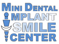 Dental Implants San Diego