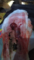Klinik ubat gugur Kandungan Selangor/Johor bharu