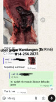MMKIT PIL GUGUR KANDUNGAN MAMPU MELANCARKAN HAID/PIL MISOPROSTOL GUGUR KANDUNGAN 2026 5-6BULAN UBAT GUGUR COD/POS READY STOCK