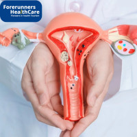 Top Ovarian Cancer Hospitals in India
