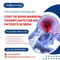 List of Doctors for Bone Marrow Transplant for MS India
