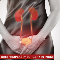 Cost of Urethroplasty Surgery India