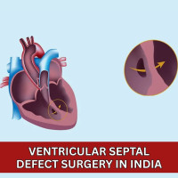 Cost of Ventricular Septal Defect Surgery India