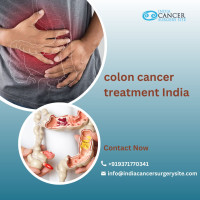 Best Doctor for Colon Cancer in India