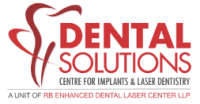 Teeth Whitening in Bangalore | Laser Whitening Cost & Treatment