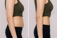 Phentermine: A Potent Friend for Your Weight Loss and Health Improvement Path
