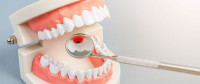 Get a Natural, Beautiful Smile with Veneers in Converse, TX