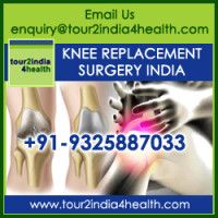 Knee Replacement Surgery Cost India