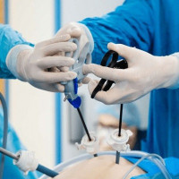 laparoscopic in islamabad pakistan