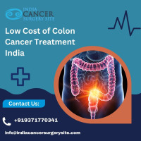 Affordable Colon Cancer Treatment India