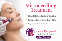 Professional Microneedling Surrey | Purely Pampered Aesthetics & Laser