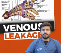 Venous Leakage Treatment