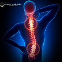 Top Robotic Spine Hospitals in India